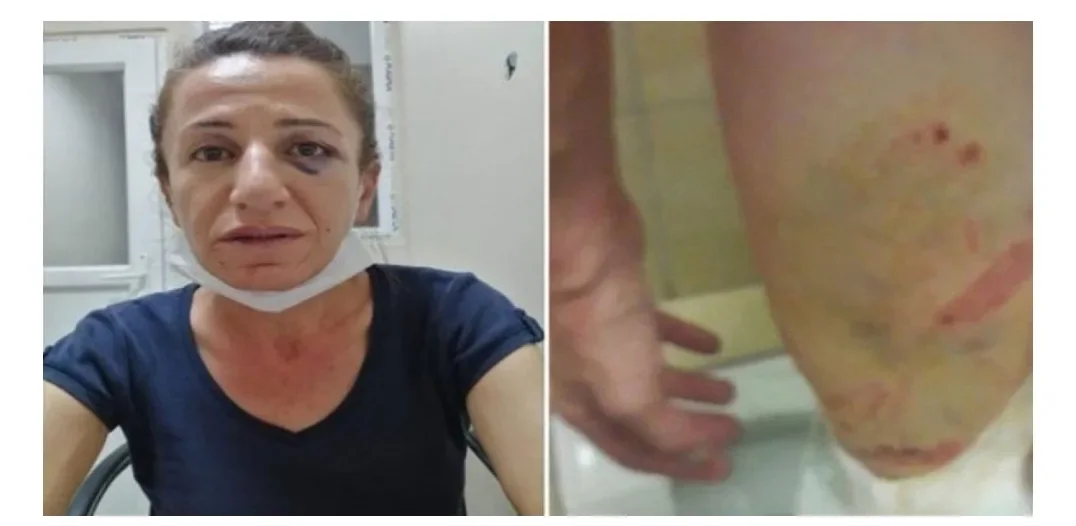 ROJBİN CETIN TUTUKLANDI