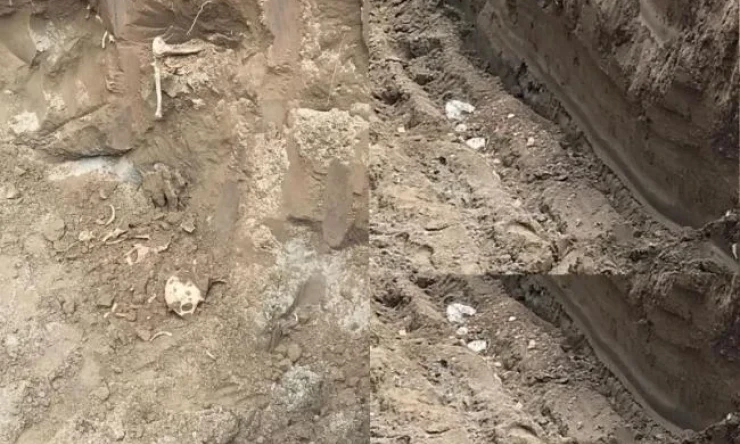 Iğdır'da Bir İnşaatın Temelinde Kemikler Ortaya Çıktı..!