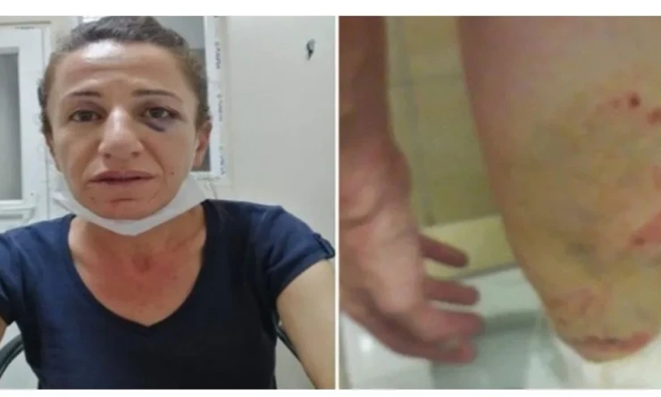 ROJBİN CETIN TUTUKLANDI