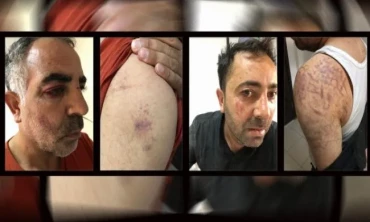 Halis Güney’inin gözaltındaki İşkenceye İlişkin Suç Duyurusunda bulundu