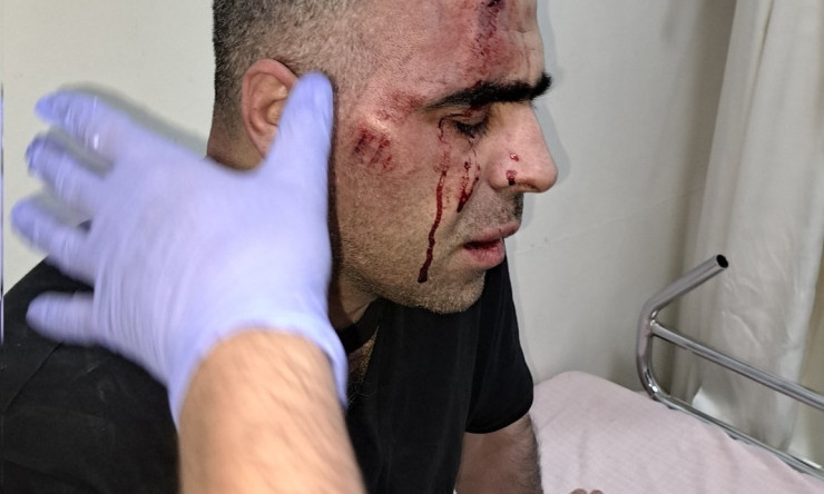 Gazeteci Sinan Aygül'e Saldırı Anı Güvenlik Kamerasına Yansıdı