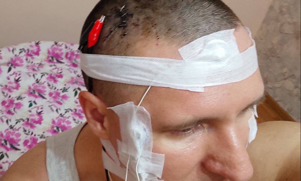 Rusya'da Bir Adam Rüyalarını Kontrol Etmek İçin Kendi Kafasına Çip Yerleştirdi