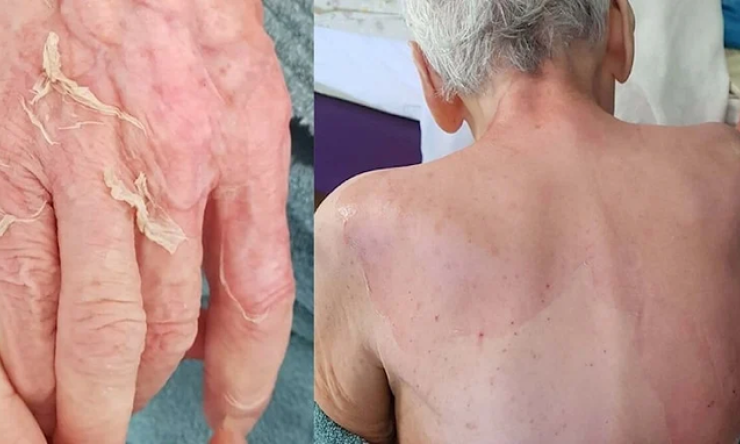 İzmir Huzurevi Olayında Dava Açıldı: Yaşlı Kadının Ölümüyle İlgili İddialar