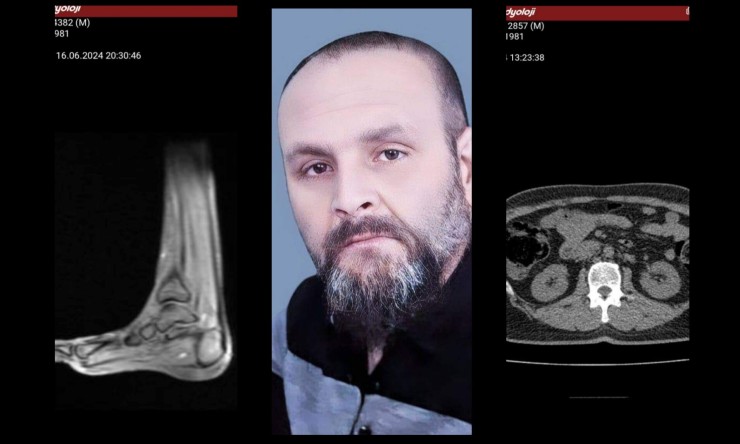 Sevgili Dostlarım, "Hayatımda Acı Gerçekleriyle Yüzleşmek: Sağlık Mücadelem ve İçsel Güçlenme"