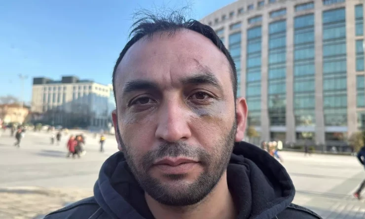 İstanbul'da Akılalmaz Tuzak: Sevgilisinin Evinde Saldırıya Uğradı, Darp ve Gasp Kamerada!